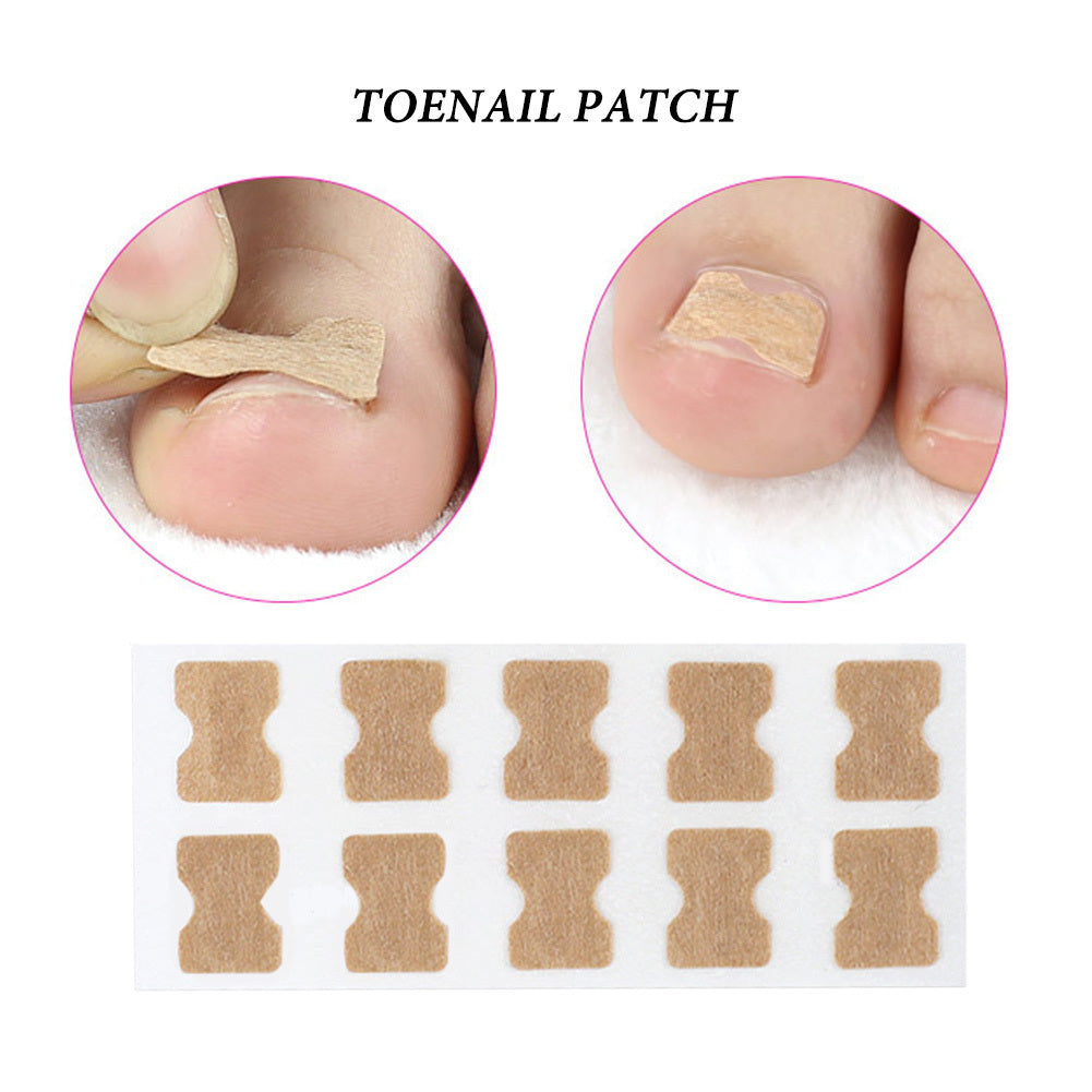 Ingrown Toenail Corrector Sticker - MERLIÁ